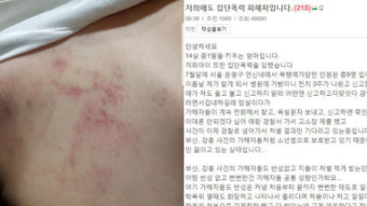 "머리·배는 때려도 티 안나" 서울 은평구 여중생 집단 폭행