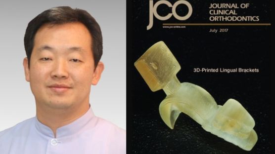 부산대-디오 공동개발한 '3D프린트 치아교정' 미 전문학술지 표지에 선정