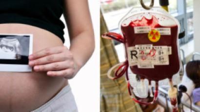 “임신 전력있는 여성에 수혈받은 男, 3년 내 사망률 17%“