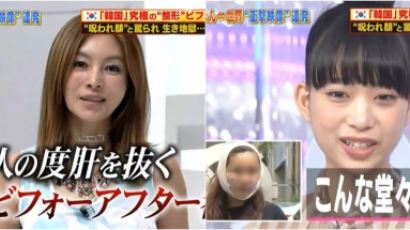 韓은 취직도 외모 중시…일본 방송서 소개된 ‘한국 성형 문화’