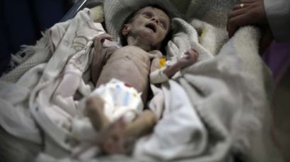 시리아의 비극 … 1개월 아기가 2㎏