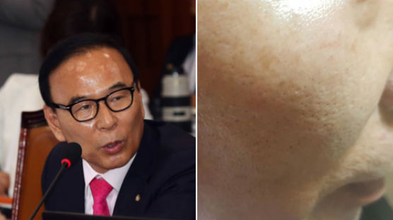 박덕흠 한국당 의원, "민주당 군의원에 폭행당했다" 진실공방