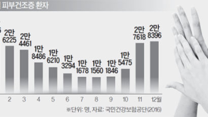 [건강한 당신] 겨울 불청객 정전기, 뜨거운 물 목욕 피해야