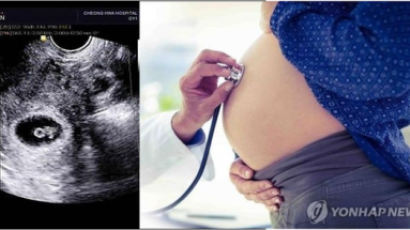 미국서 첫 자궁이식 출산 성공…2014년 스웨덴 이어 두 번째 