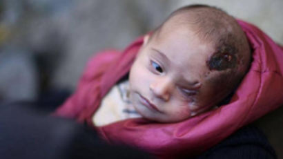 전쟁으로 눈 잃은 아기 위해 전세계 사람들이 한 일