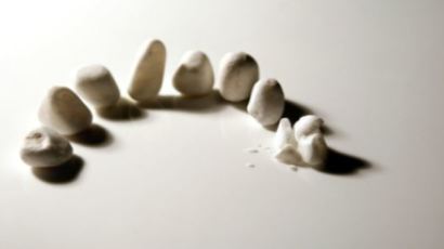 “4년간 인공치아 11만개 불법제조” 유통·시술까지한 치과의사