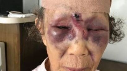 미 LA 한인타운 할머니 폭행 용의자 체포