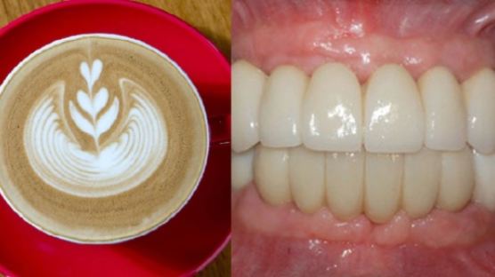 “커피 매일 마시면 치아 잃을 위험 1.7배 높아진다”