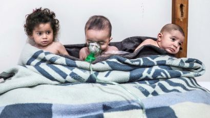 [서소문사진관] 독가스에 쓰러진 아이들, 시리아 어린이들의 고통은 언제까지...