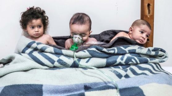 [서소문사진관] 독가스에 쓰러진 아이들, 시리아 어린이들의 고통은 언제까지...