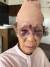 LA 한인타운에서 80대 한인 여성이 묻지마 폭행을 당했다. [사진 피해자 손녀 고유진씨 페이스북 캡쳐]