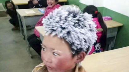 또 시련에 빠진 中 '눈송이 소년' 왕푸만…"학교서 쫓겨났다"