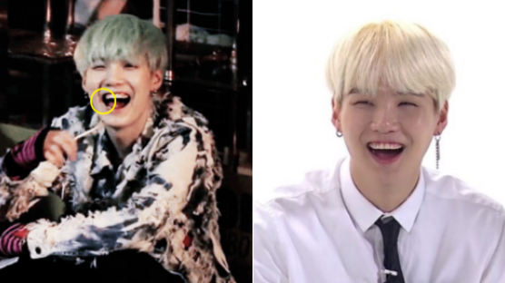 SUGA of BTS Comes Second on “K-pop Idols with the Most Attractive Smile Ranking”