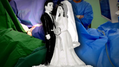 “결혼·이혼·별거한 수술환자, 비혼보다 사망위험 30% 낮다” 