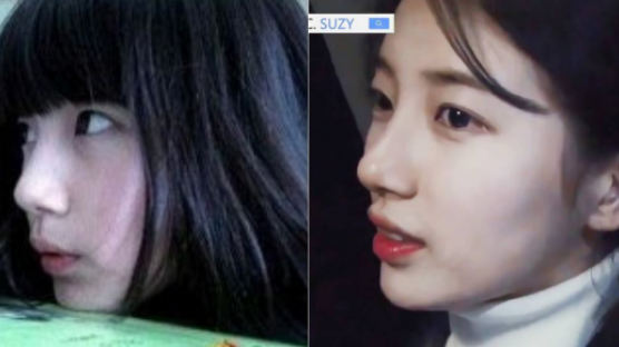 PHOTOS: Side Face of SUZY Who Always Had Sharp Nose
