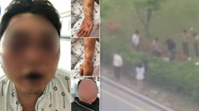 “동생이 집단폭행 당해 실명 위기” 광주폭행 피해자 형의 호소