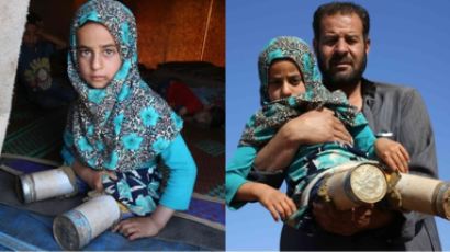 버려진 깡통으로 의족을…8살 시리아 난민 소녀의 꿈