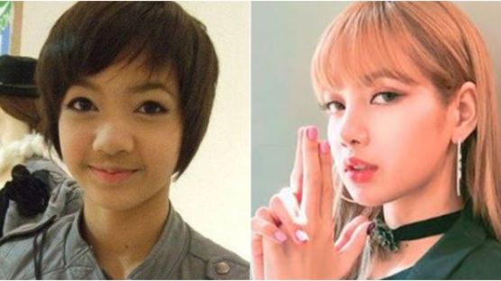 Past Photos That's Been Bothering LISA… Is the Plastic Surgery Rumor True?