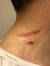 기동민 의원이 올린 김경수 경남지사의 목 부분 상처. [사진 기동민 의원 페이스북]