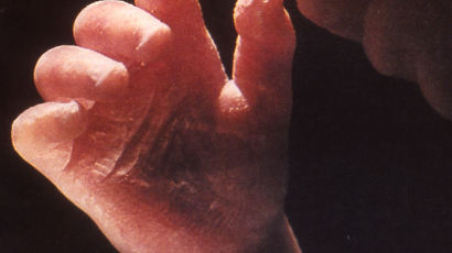 태아의 손가락이 형성되는 '세포자멸의 속도', '시속 2mm'