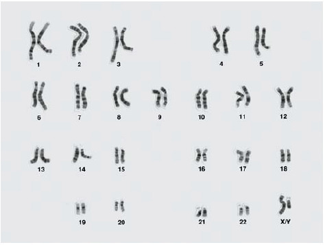 남성의 염색체 사진 [미국립인간지놈연구소]