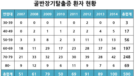 '골반장기탈출증' 수술 환자 10명 중 8명은 60대 이상