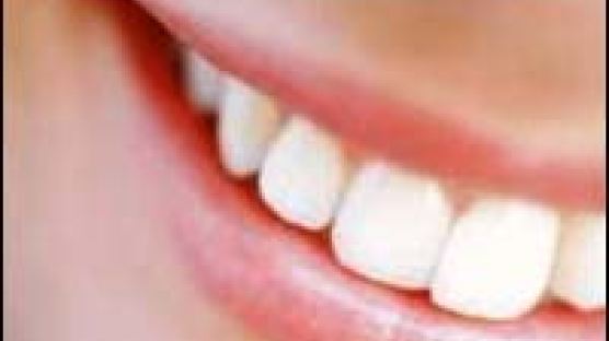 새로운 치과 치료법 … 미용·기능 동시에 추구한다