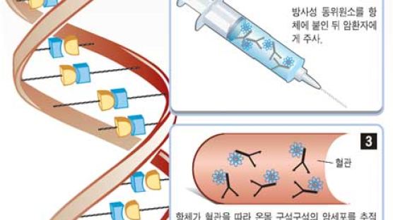 [과학] '방사성 동위원소' 로 암세포만 골라 죽인다