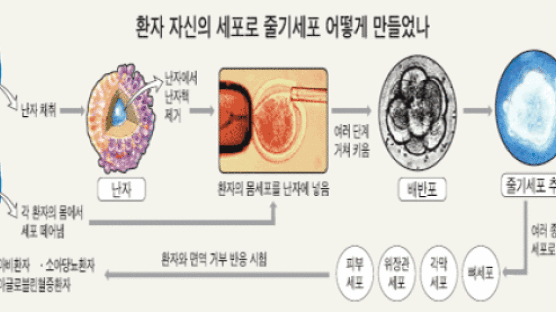 환자 몸에서 채취한 세포로 본인 치료용 줄기세포 배양