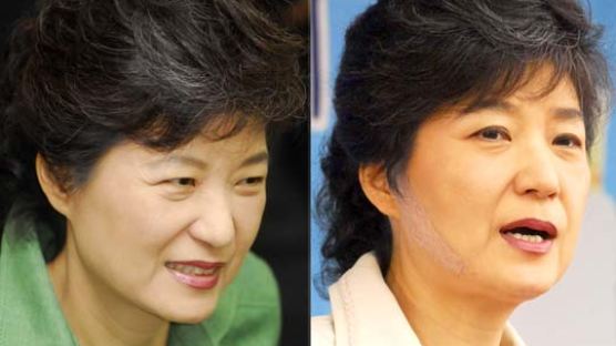 [사진] 박 전 대표 얼굴 상처 치료 끝내