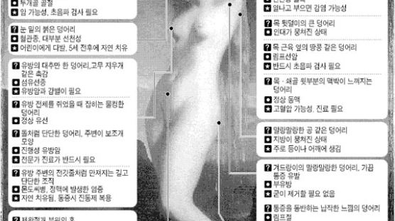 [Family건강] 가슴·뒷목에 없던 멍울이 … 혹시 암 ?