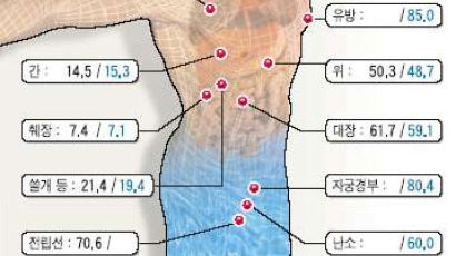 1998 ~ 2002년 암 환자 40여만 명 추적해 보니