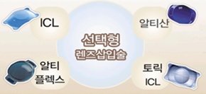 안내렌즈삽입술 필수검사로 부작용 예방 | 중앙일보