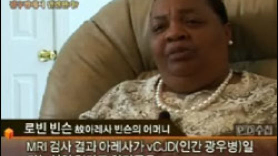 “빈슨 어머니 CJD와 vCJD 구분 PD수첩서 인터뷰 누락시켜 왜곡”
