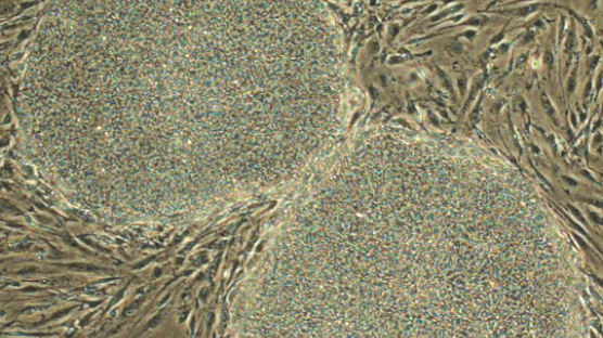 한국 줄기세포 연구 다시 쑥쑥 자란다
