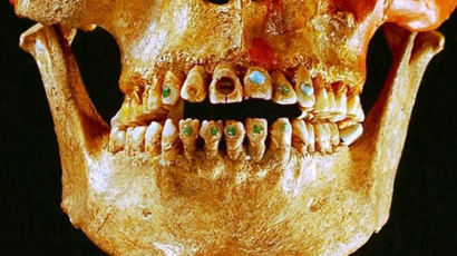 2500년 전 멋쟁이들은 치아에 보석을 박았다?