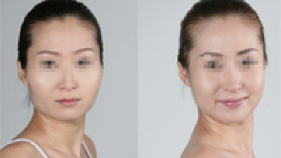 서양인보다 얼굴 커 보이는 한국인, ‘광대뼈’가 원인