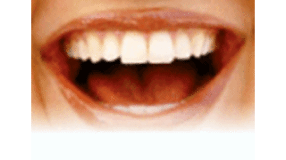 구릿빛 피부의 포인트는 하얀 치아!