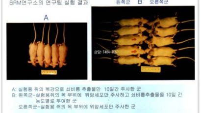 B형 간염바이러스,간암 면역요법으로 치료된다