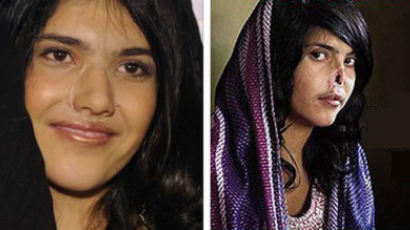 [사진] 얼굴 되찾은 아프간 여인