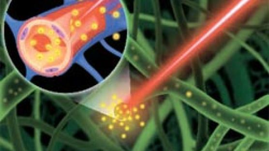 뇌 속 약물 전달하는 레이저 원천기술 개발