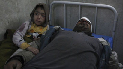 [사진] 폭탄 테러로 부상을 당한 부자