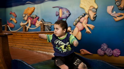 [사진] 희귀 유전병 앓고 있는 팔레스타인 어린이