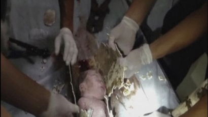 [사진] 변기 하수구에서 발견된 갓난아기