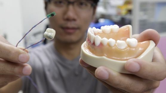 [사진] 입 움직임 감지하는 '스마트 이빨' 시제품