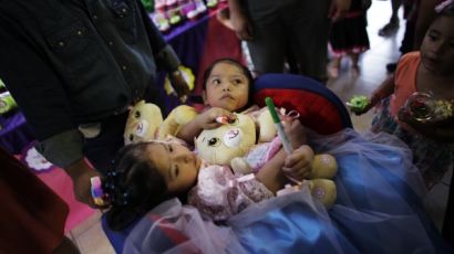 [사진] 네 살된 멕시코의 샴쌍둥이 자매