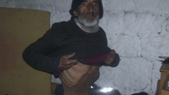 [사진] 실종 4개월만에 구조된 우루과이 남자