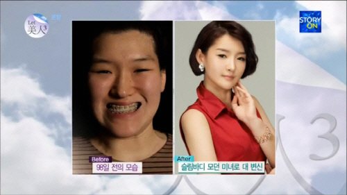 렛미인3' 쓰레기 집에 갇힌 배은정 씨, 반전외모로 마음의 고통까지 비우다! | 중앙일보