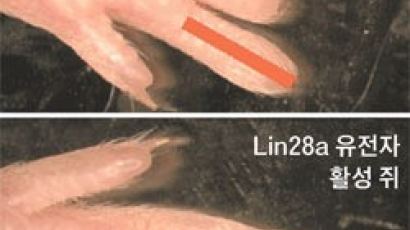 청춘의 샘 유전자 "상처 회복력을 높이는 기능 Lin28a, 미래의 복합치료제?"