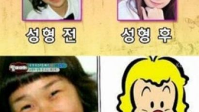 박소영 성형전후, "눈·코·입만 했다"…"누구세요?"